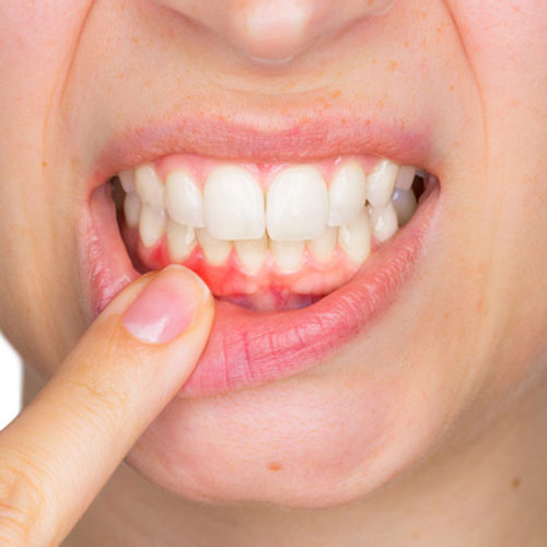 Periodontology (Gum Treatment)