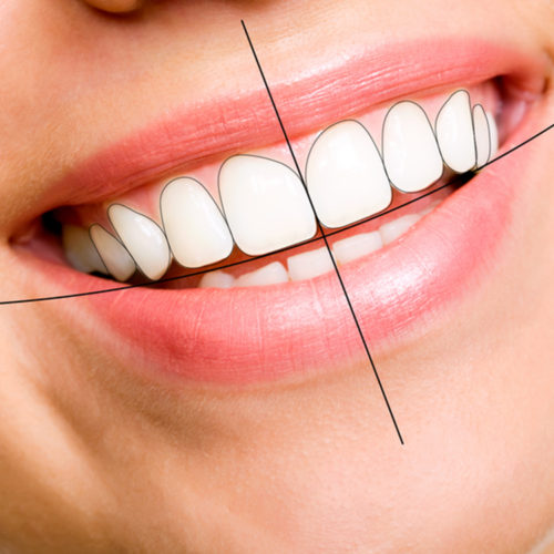 Digitale Smile Design
