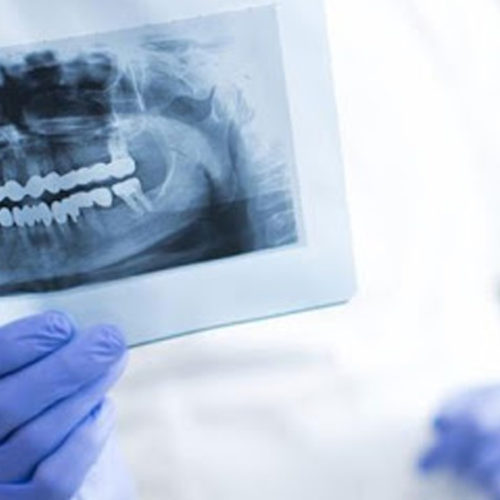 Oral Diagnose and Radiology