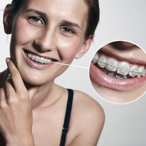 Orthodontics