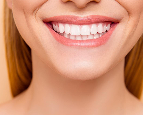Composite Bonding