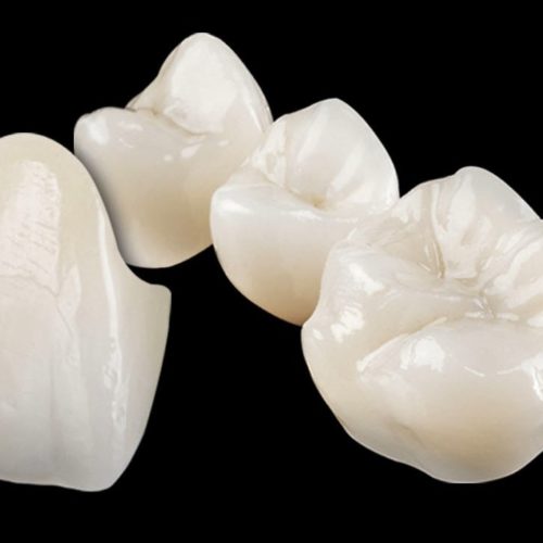Zirconia Crowns