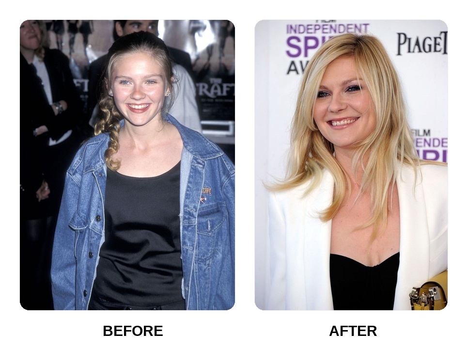Are Kirsten Dunst teeth asymmetrical?