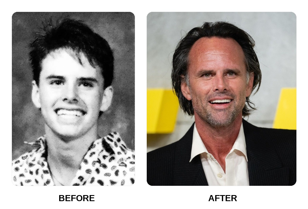 Walton goggins teeth: Walton goggins new teeth before and after