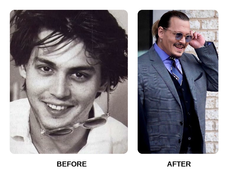 Johnny Depp teeth: Johnny Depp new teeth before and after