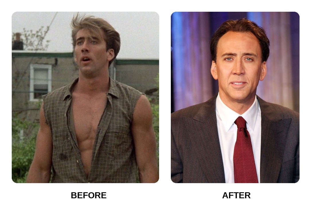 Nicolas Cage teeth: Nicolas Cage new teeth before and after