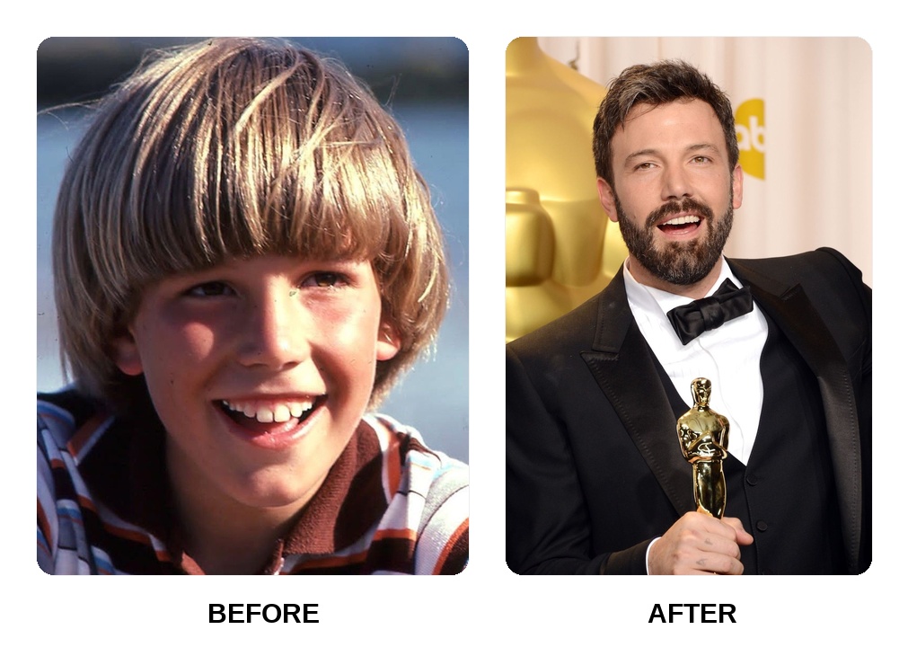 Ben Affleck teeth: Ben Affleck new teeth before and after