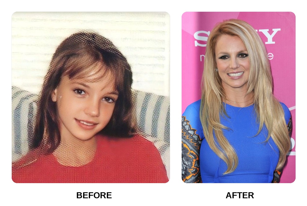 Britney Spears teeth: Britney Spears new teeth before and after