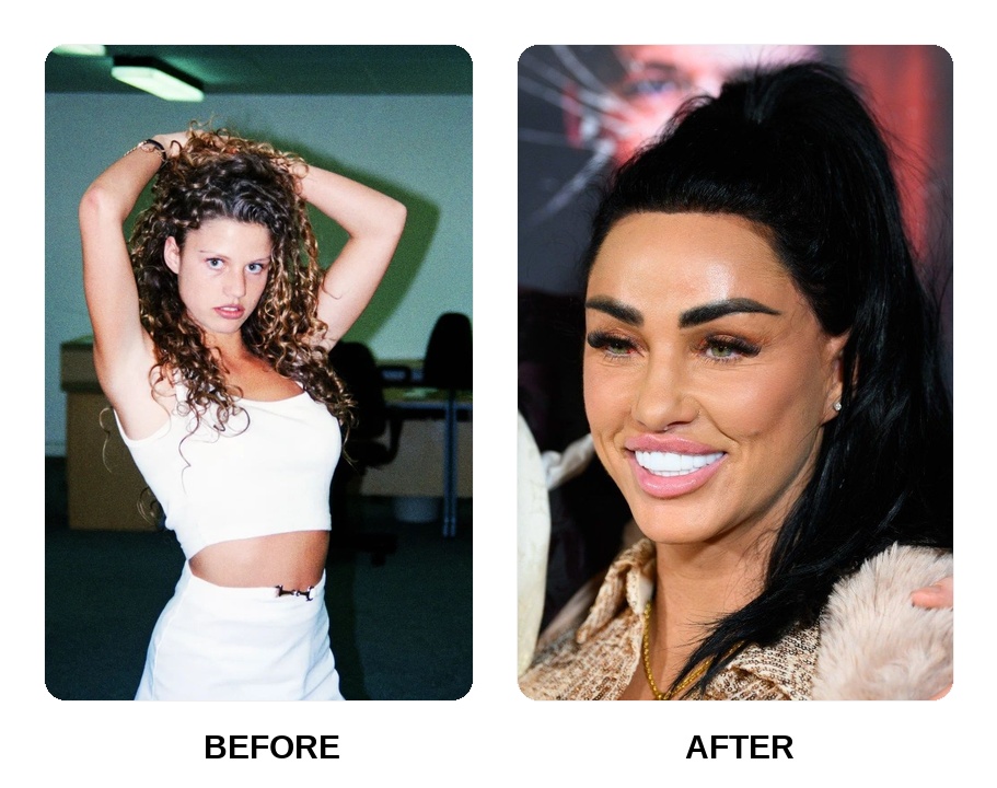 Are Katie Price’s teeth showing signs of decay?