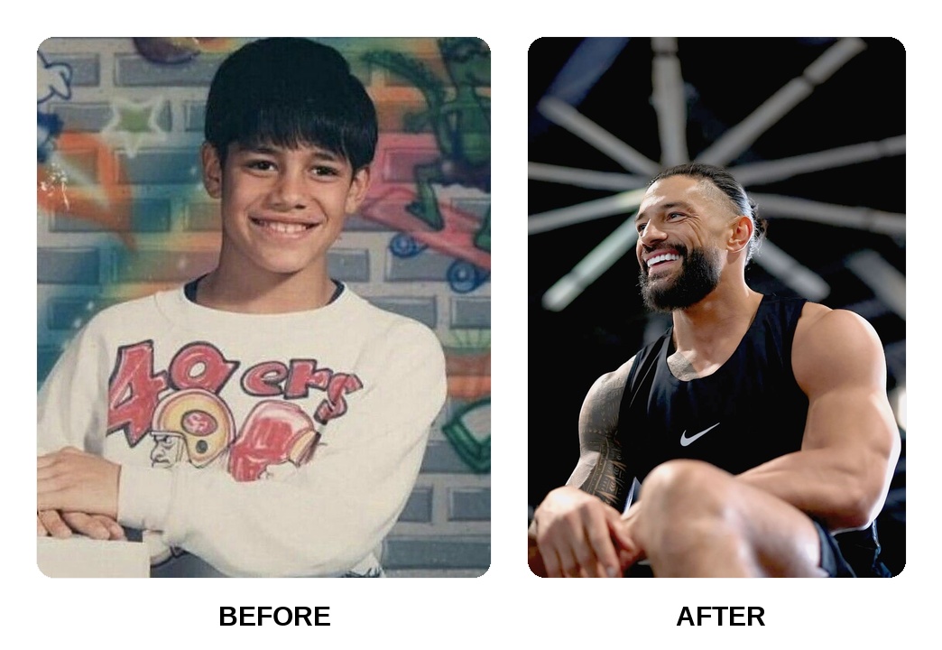 Roman Reigns dental arch