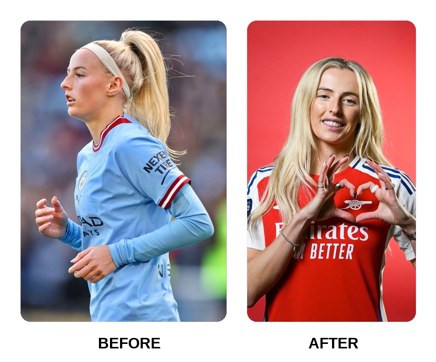 Chloe Kelly teeth in her youth