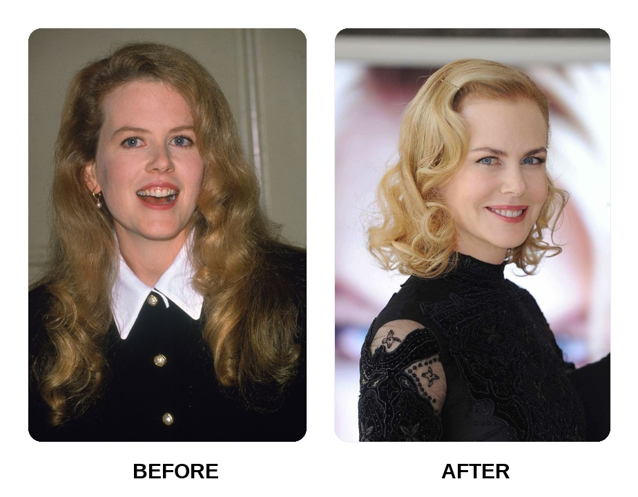 Nicole Kidman smile