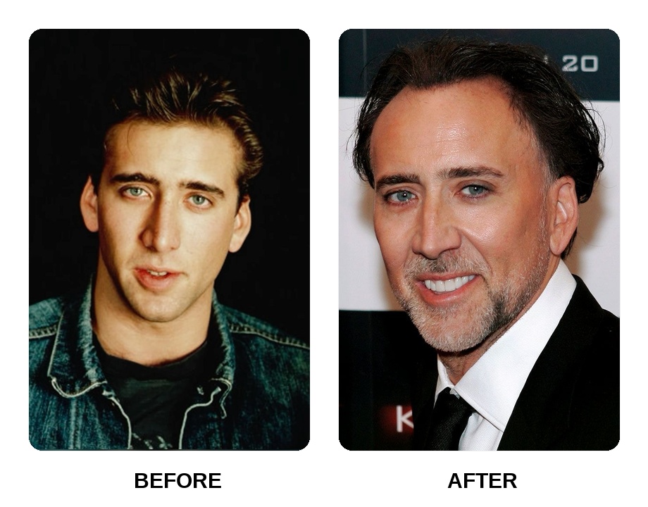 Nicolas Cage smile