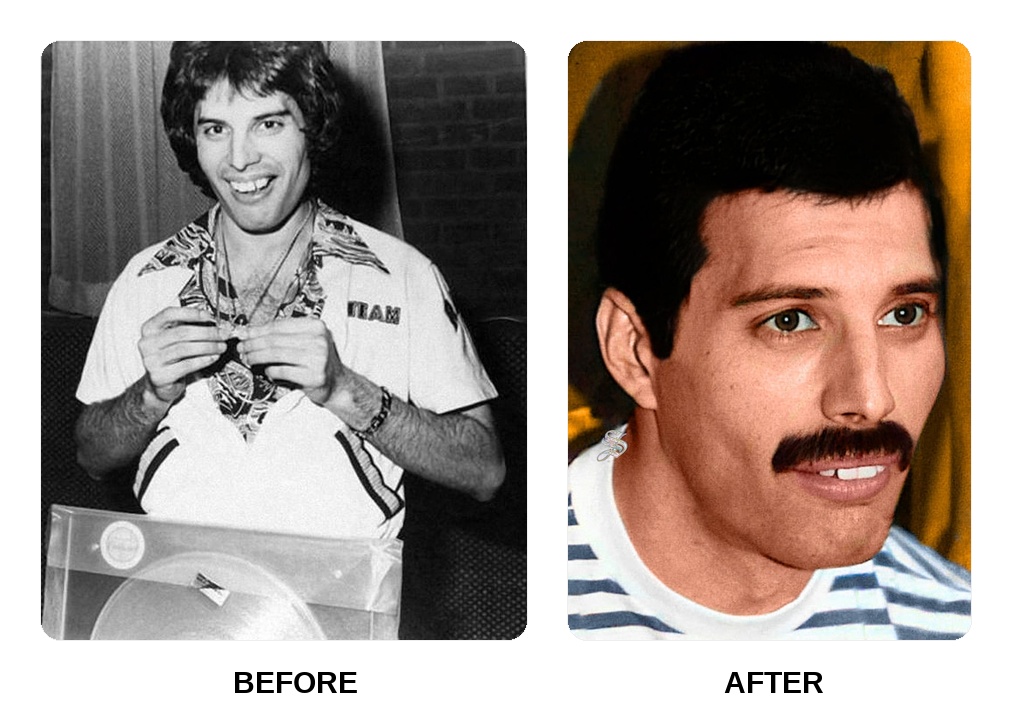 Are Freddie Mercury teeth showing signs of decay?