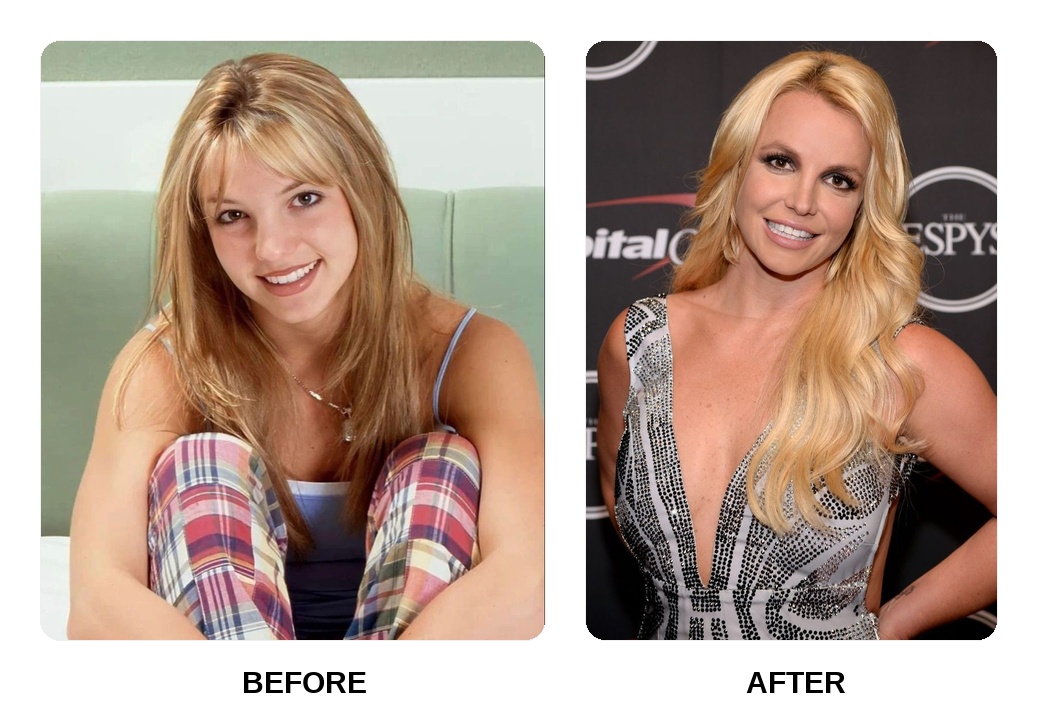 Britney Spears dental arch