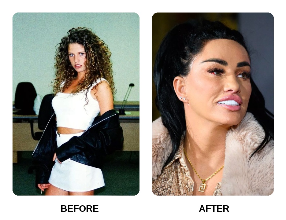 Did Katie Price get her teeth done?