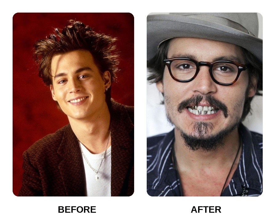 Johnny Depp teeth in his youth
