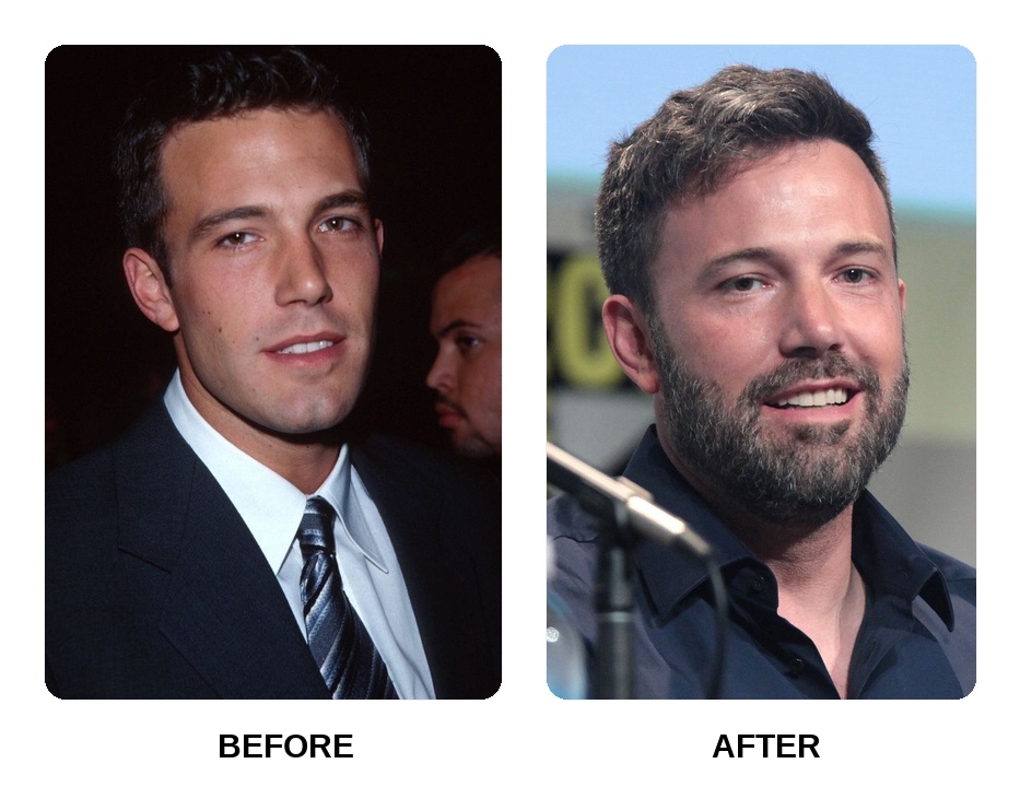Ben Affleck teeth in his youth