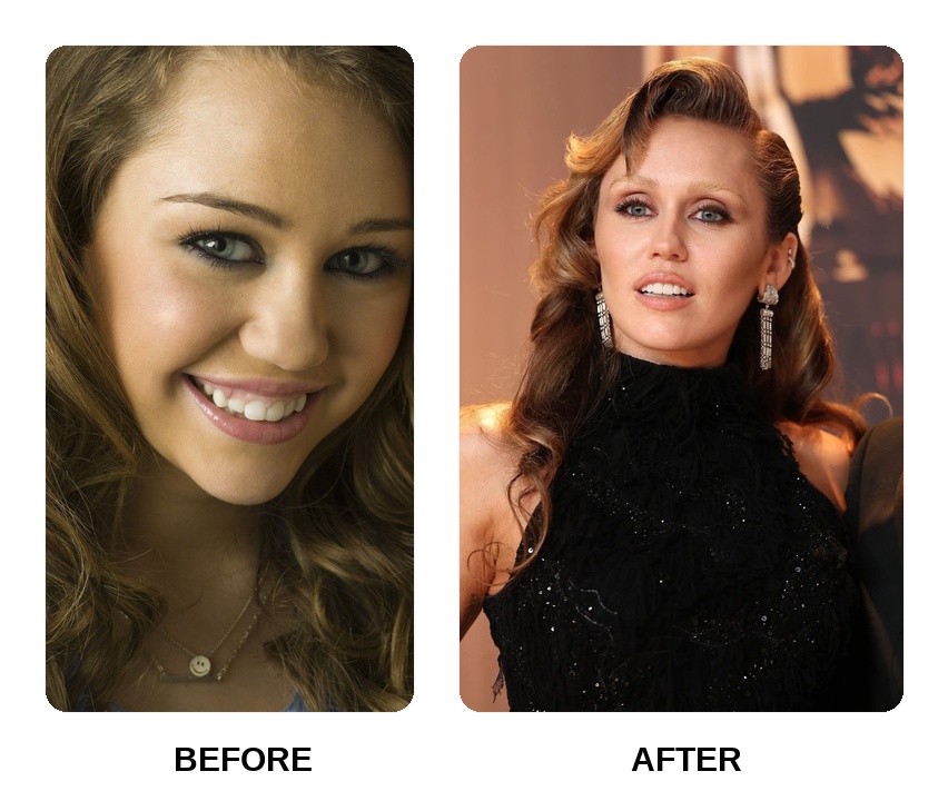 Miley Cyrus dental arch