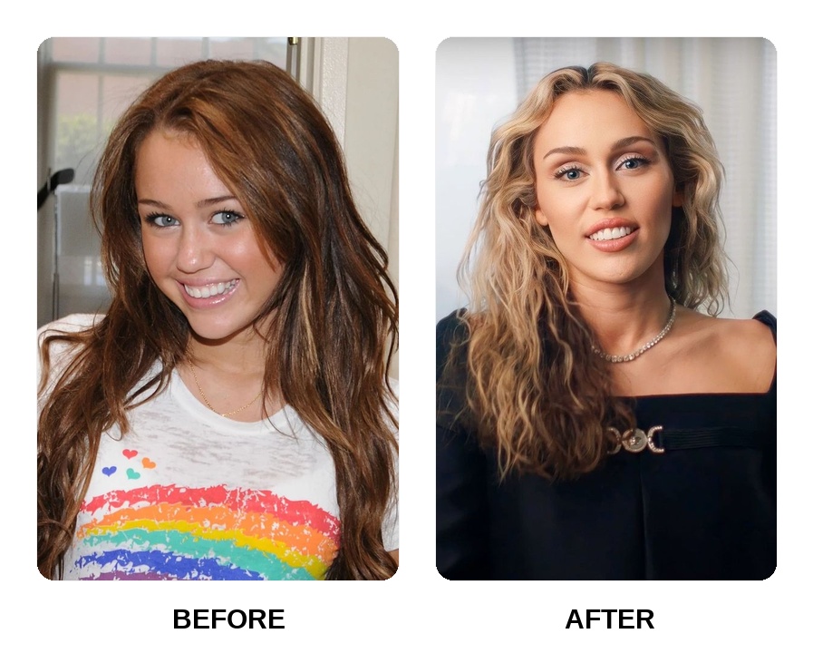 Did Miley Cyrus get her teeth done?
