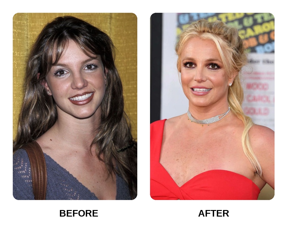Britney Spears white teeth
