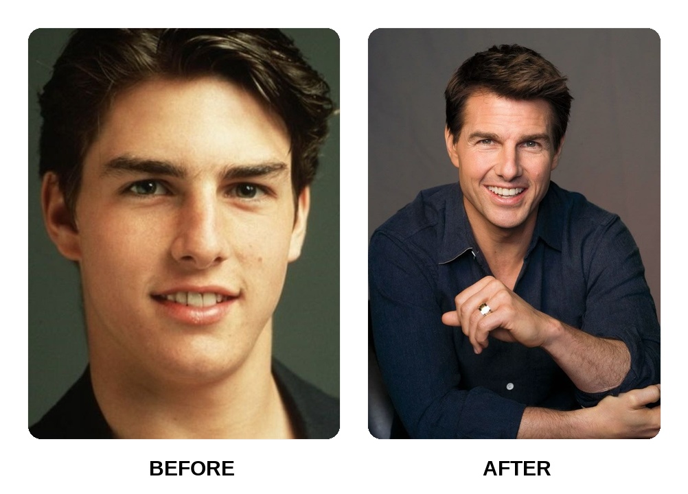 Tom Cruise Teeth in His Youth