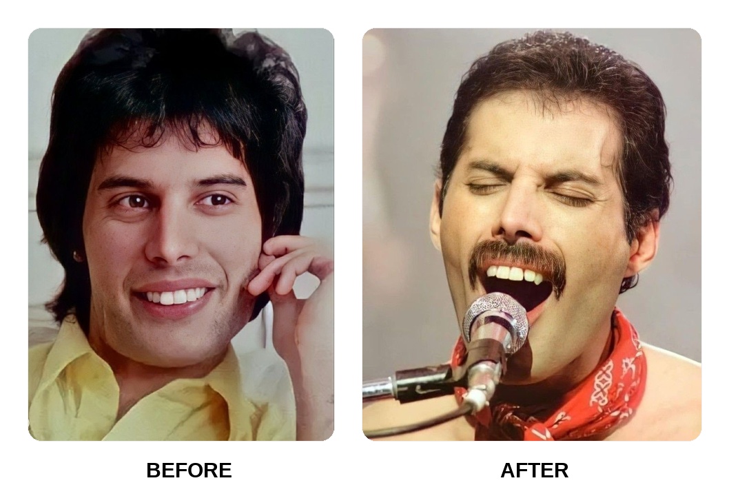 What dental procedures has Freddie Mercury undergone?