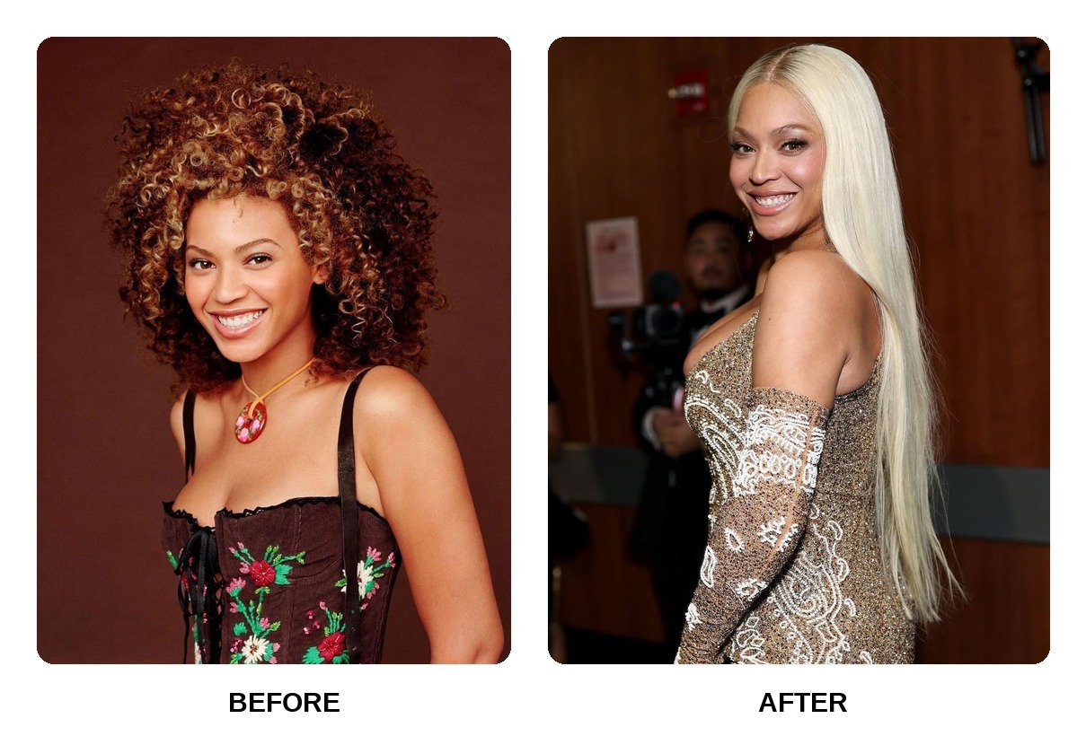 Beyonce teeth in her youth