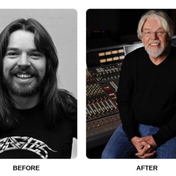 Bob Seger Teeth Before and After: What Happened in His Transformation?