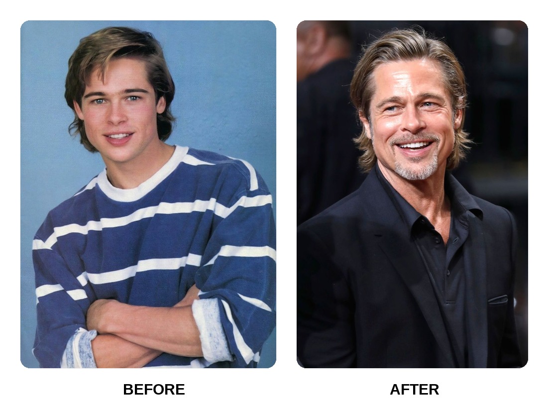 Brad Pitt teeth in his youth