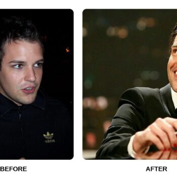 Brandon Flowers Teeth Before and After: What Happened in His Transformation?