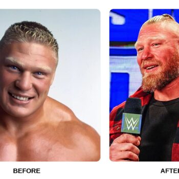 Brock Lesnar Teeth Before and After: What Happened in His Transformation?