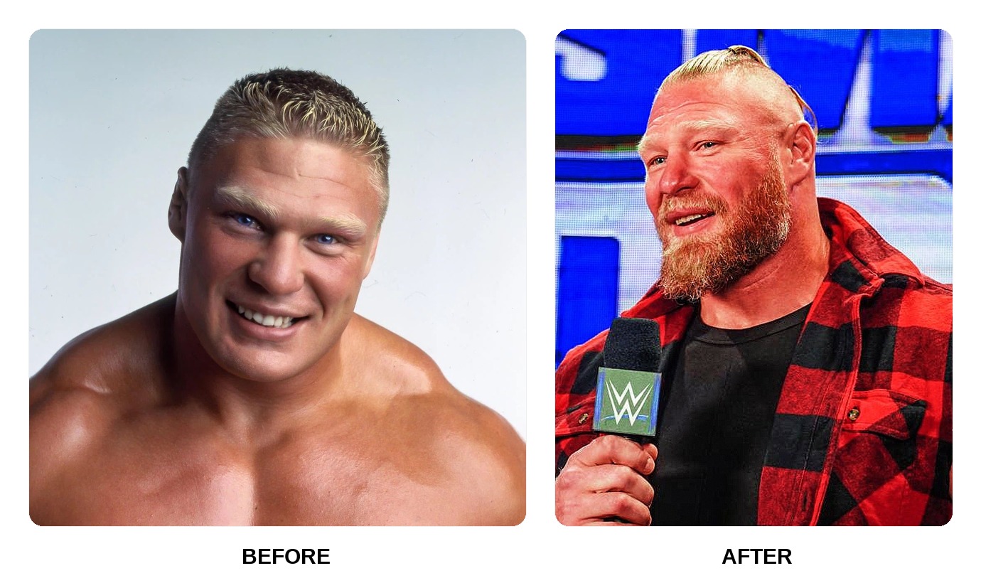 Brock Lesnar Teeth Before and After: What Happened in His Transformation?