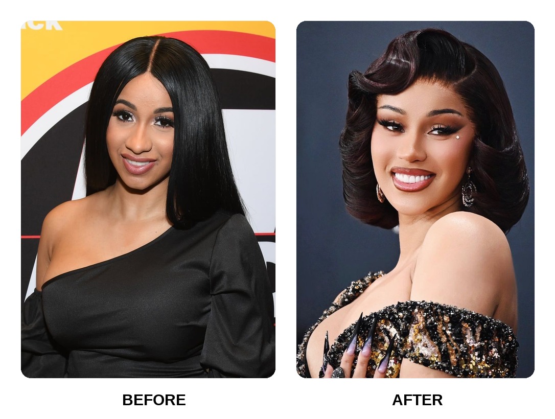 Cardi B teeth in her youth