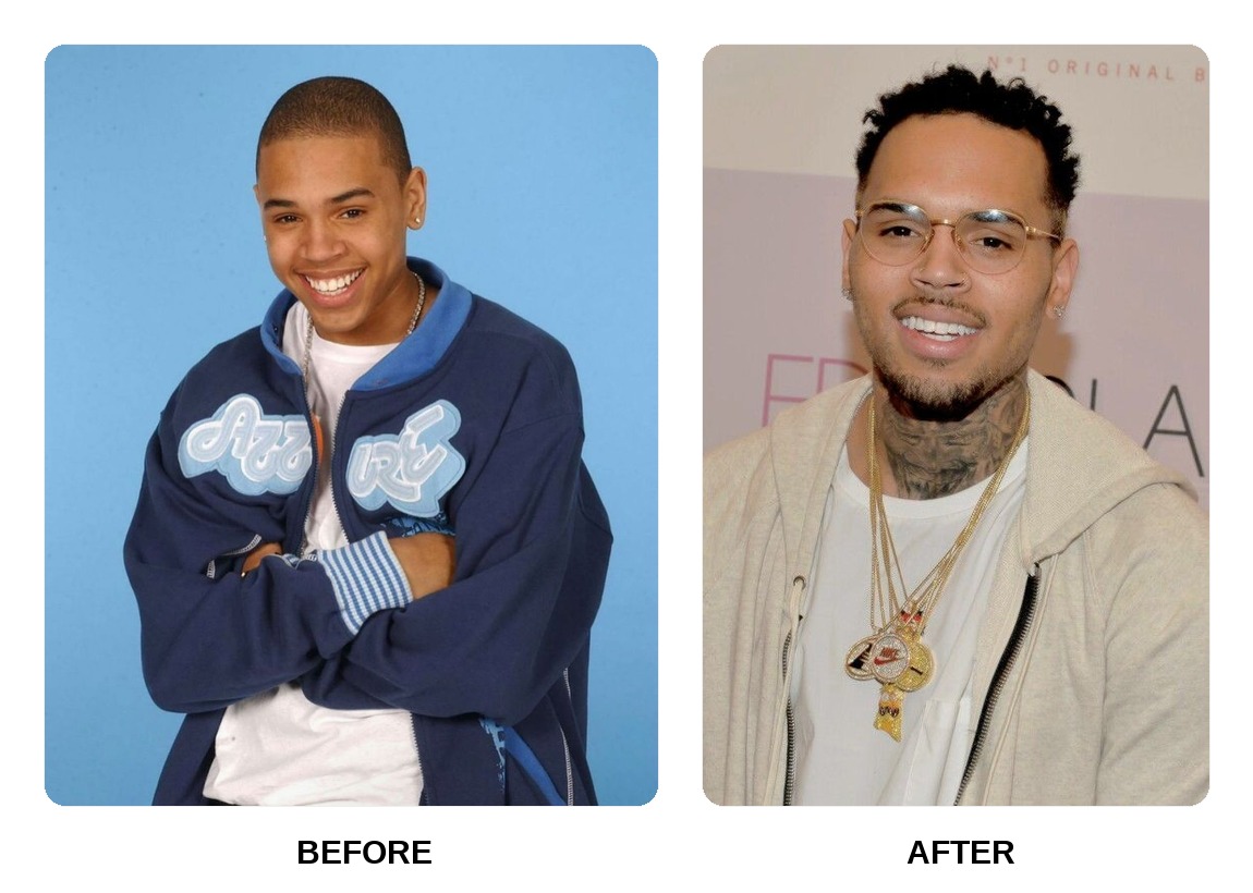 Chris Brown teeth in his youth