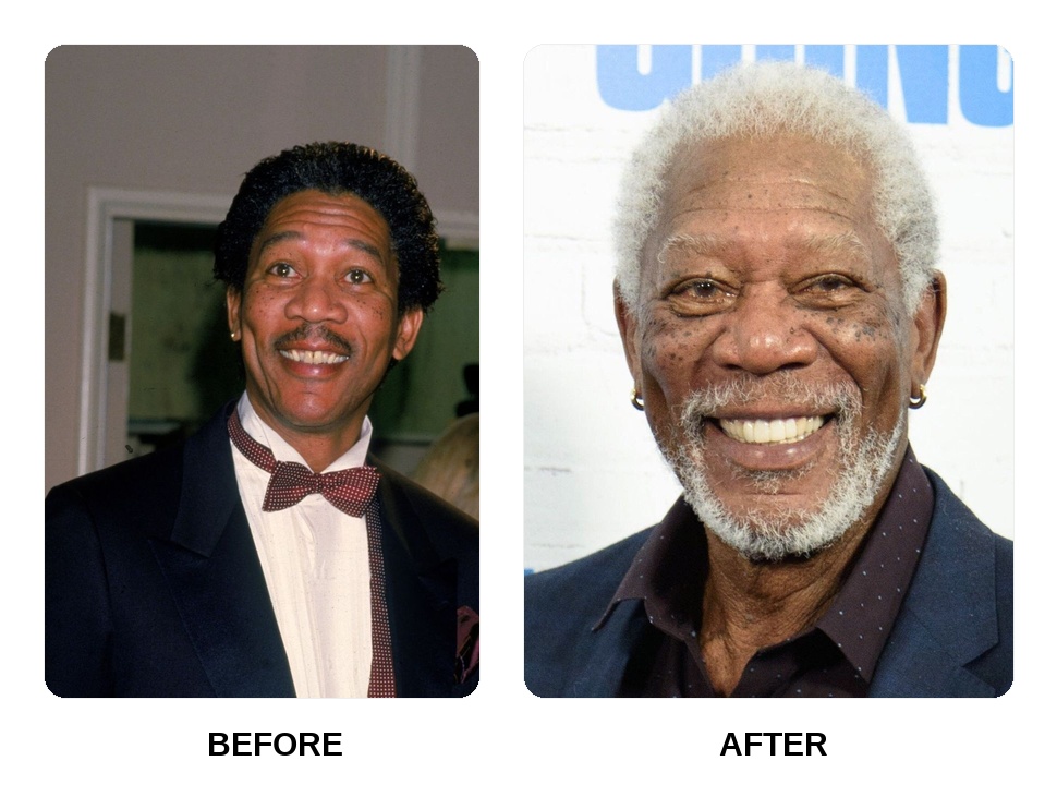 Morgan Freeman Teeth Before and After: What Happened in His Transformation?