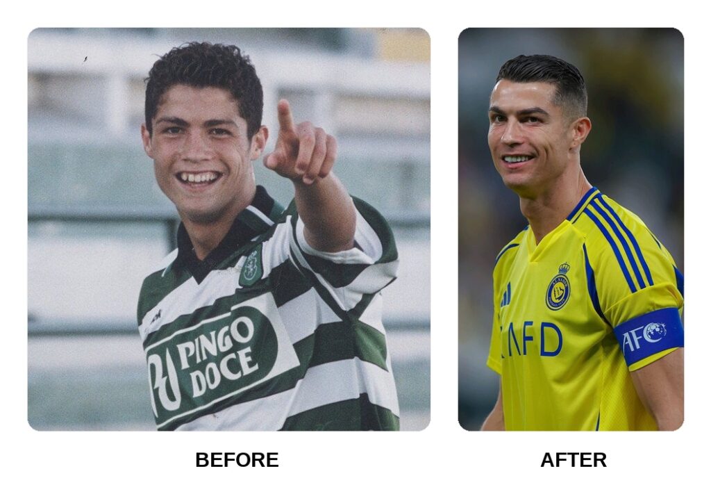 Cristiano Ronaldo Teeth Before and After: What Happened in His Transformation?