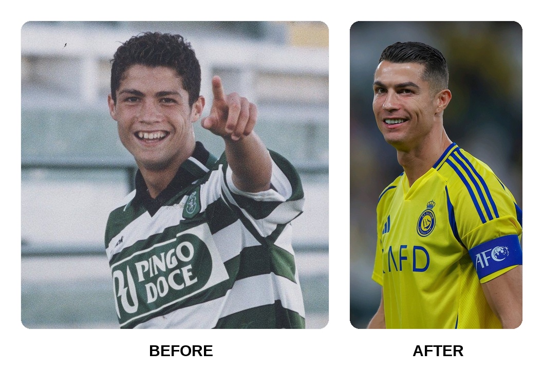 Cristiano Ronaldo Teeth Before and After: What Happened in His Transformation?