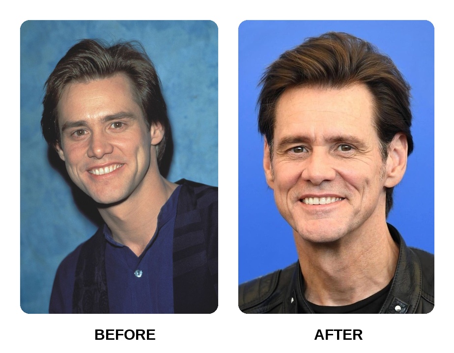 Jim Carrey Teeth Before and After: What Happened in Her Transformation?