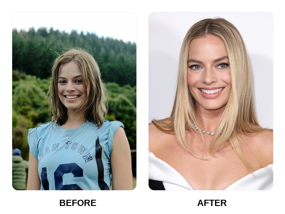 Margot Robbie Teeth Before and After: What Happened in Her Transformation?