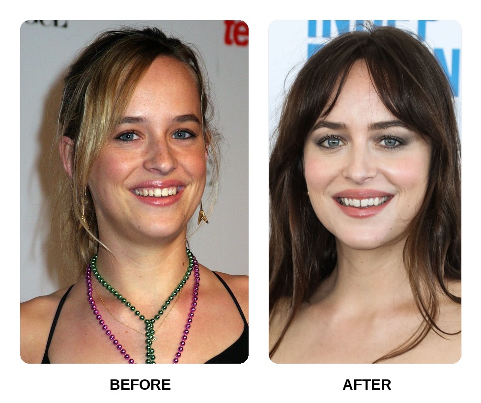 Dakota Johnson’s teeth in her youth