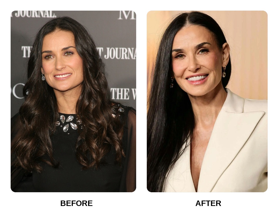 Demi Moore teeth in her youth