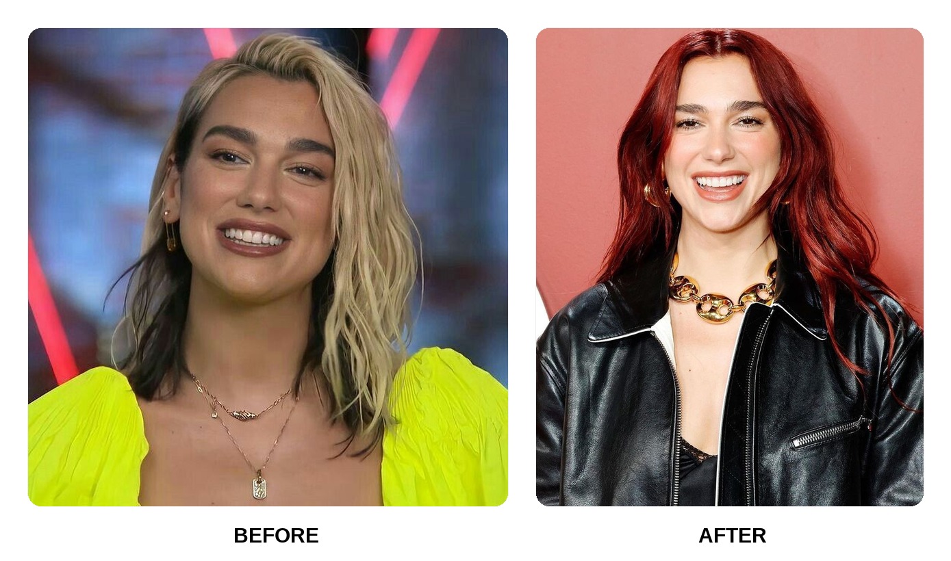 Dua Lipa teeth in her youth
