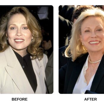 Faye Dunaway Teeth Before and After: What Happened in Her Transformation?