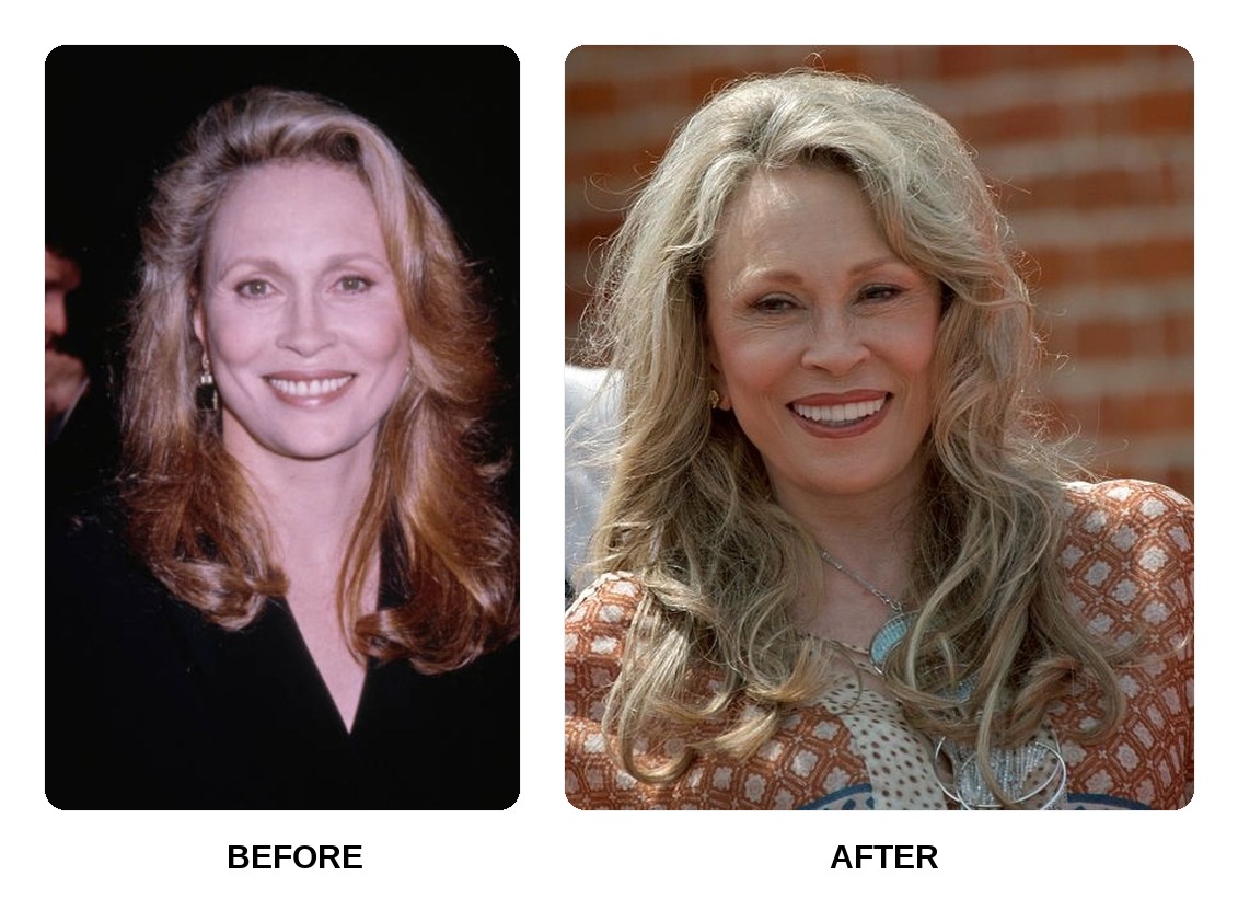 Faye Dunaway teeth in her youth