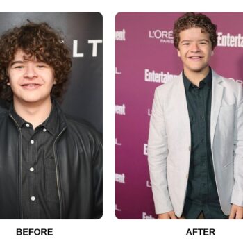 Gaten Matarazzo Teeth Before and After: What Happened in His Transformation?