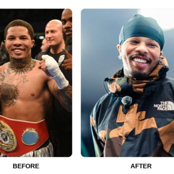 Gervonta Davis Teeth Before and After: What Happened in His Transformation?