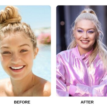 Gigi Hadid Teeth Before and After: What Happened in Her Transformation?