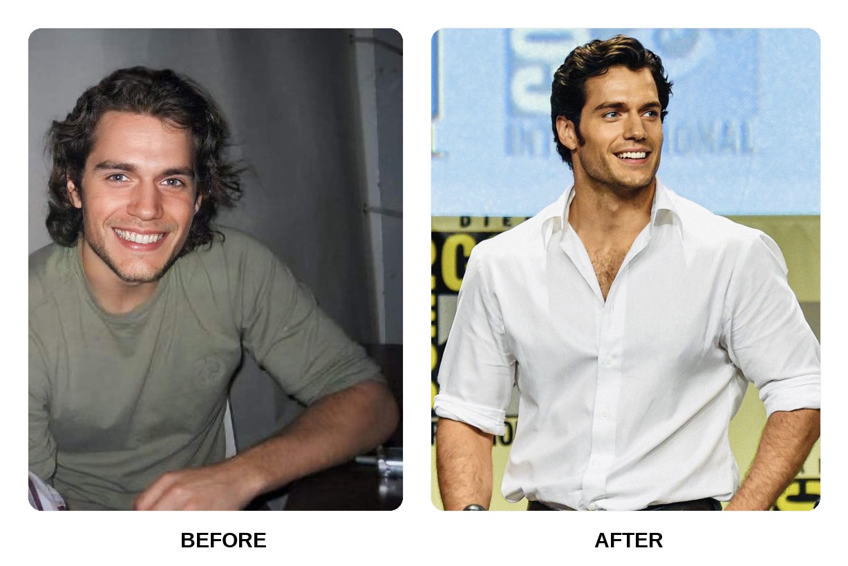 Henry Cavill Teeth Before and After: What Happened in His Transformation?