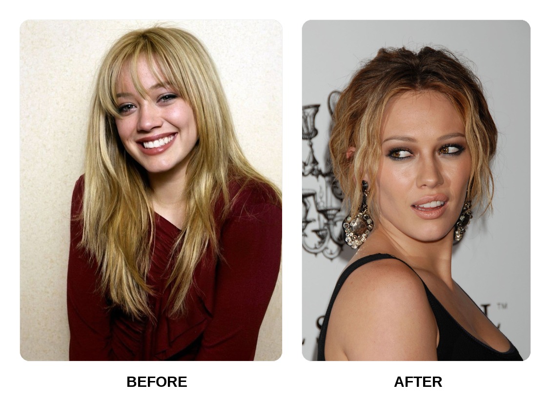 Hilary Duff teeth in her youth
